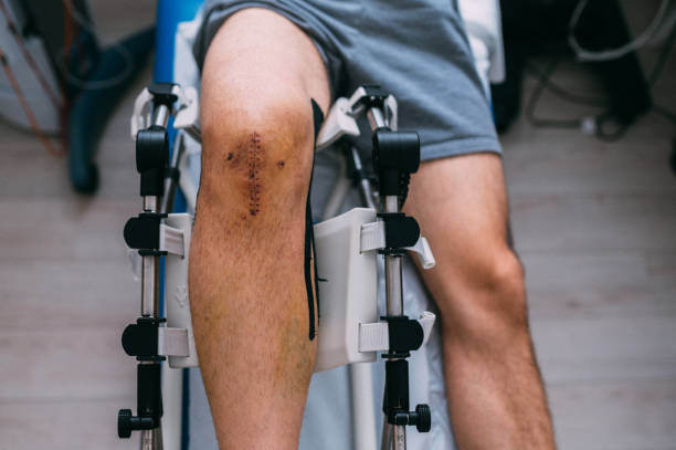 Image of a man sitting on a wheelchair with a stitch on his knee
