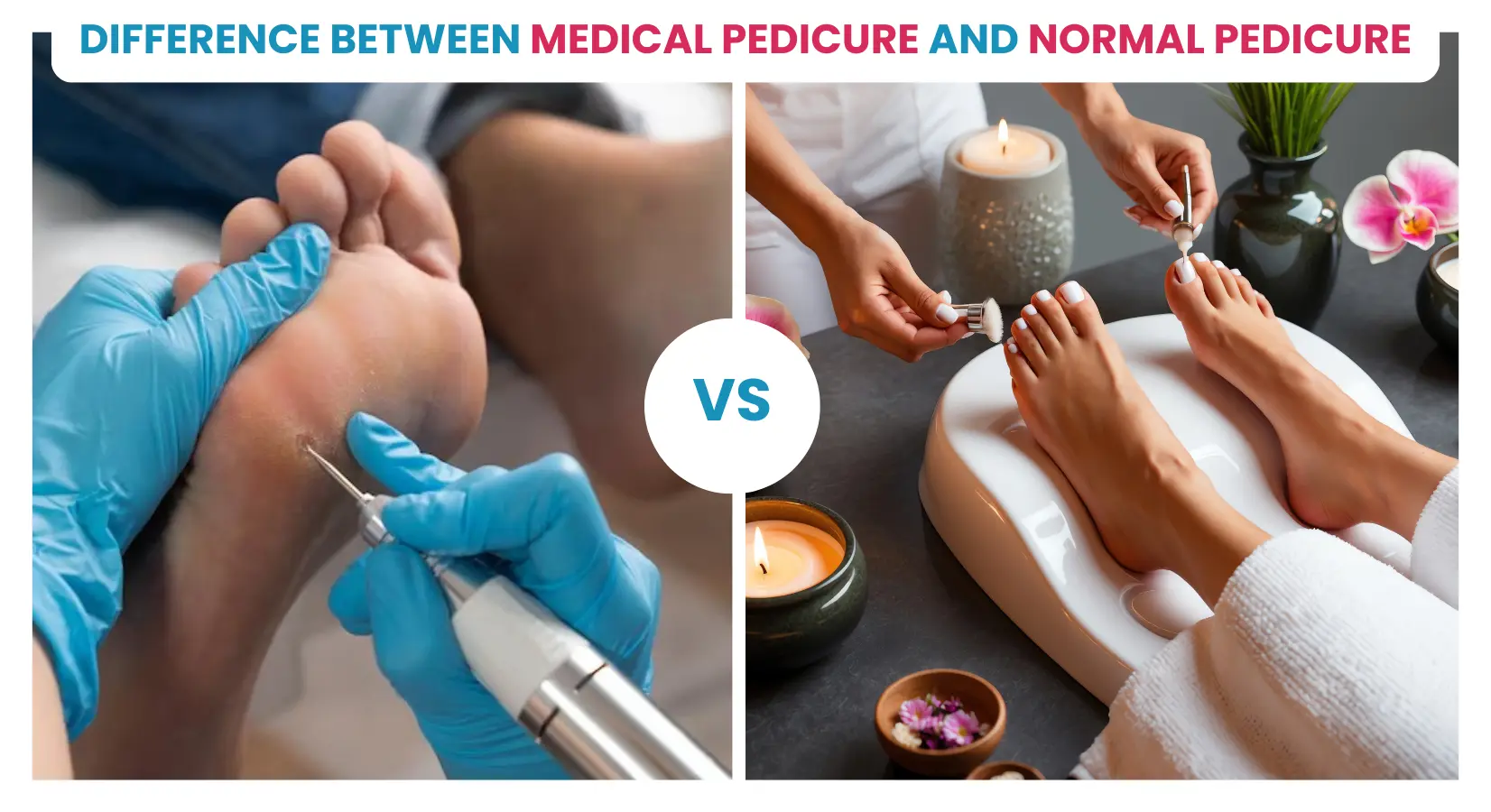 Difference Between Medical Pedicure and Normal Pedicure