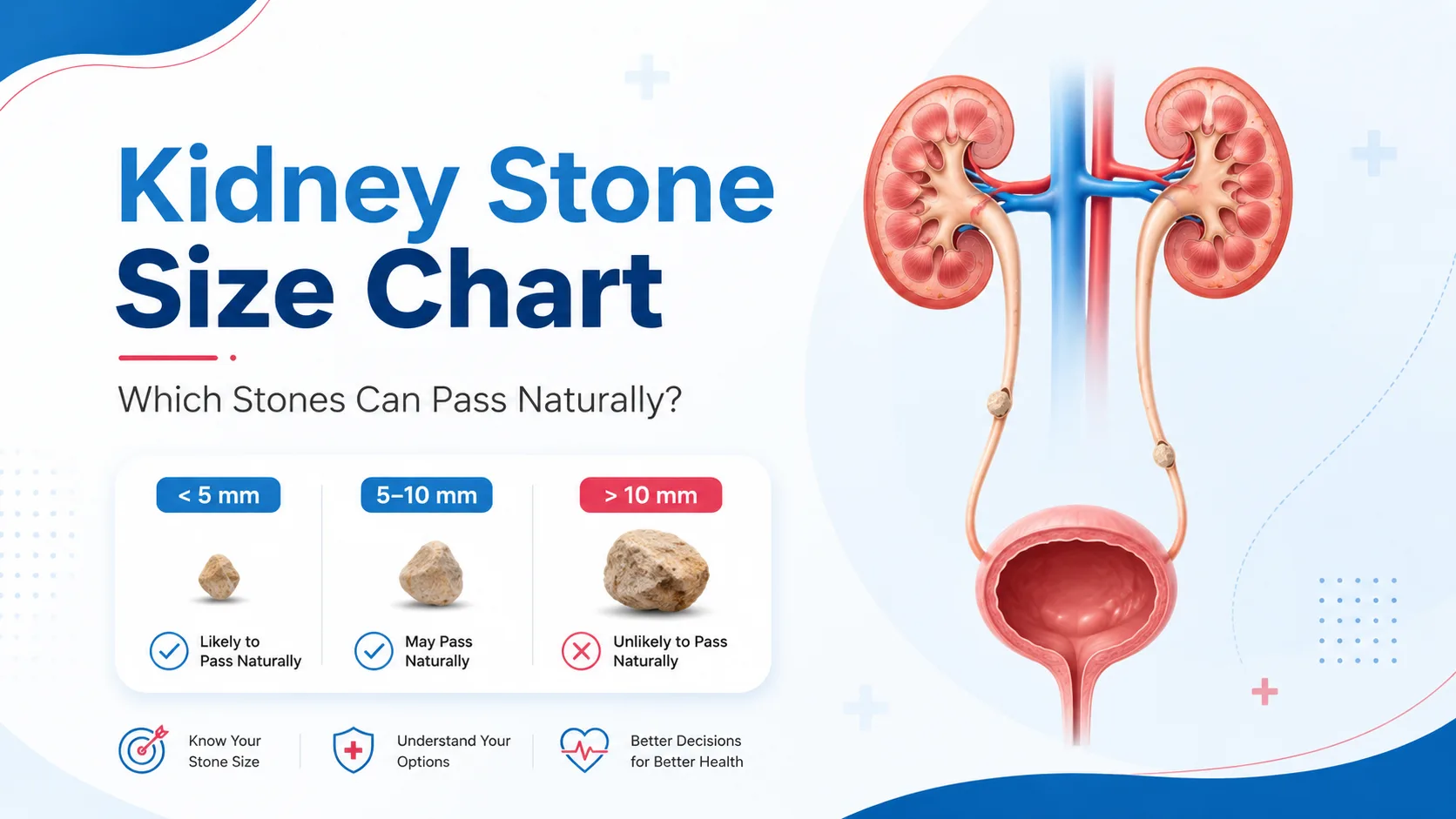 Kidney stone size chart showing which kidney stones can pass naturally and when treatment may be needed at Kapadia Hospital Mumbai
