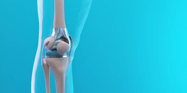 Robotic Knee Bones