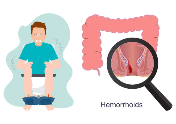 Man suffering from pilaes