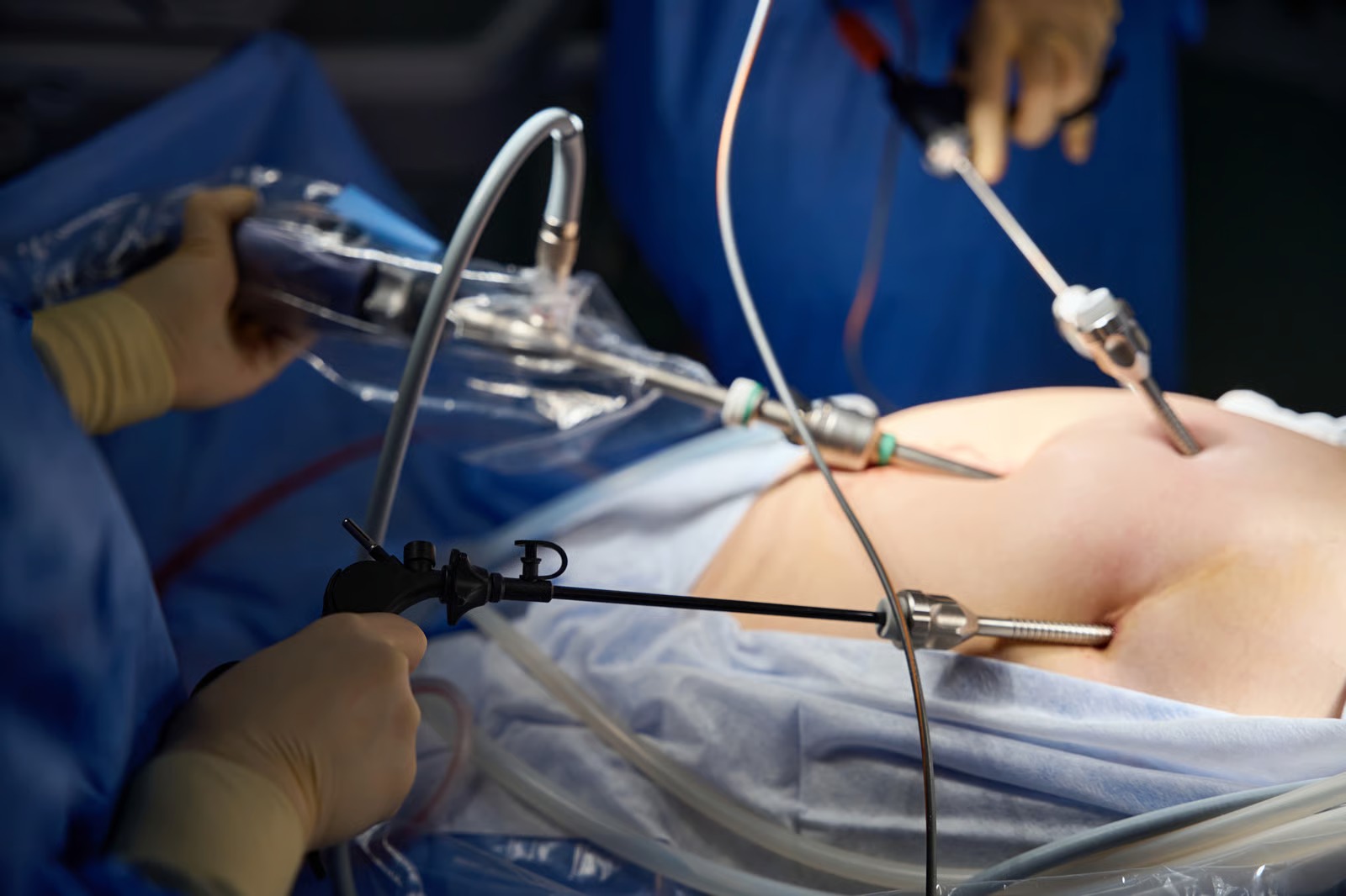 Guide to hernia operation at Kapadia Multispeciality Hospital Mumbai covering preparation, surgery and recovery