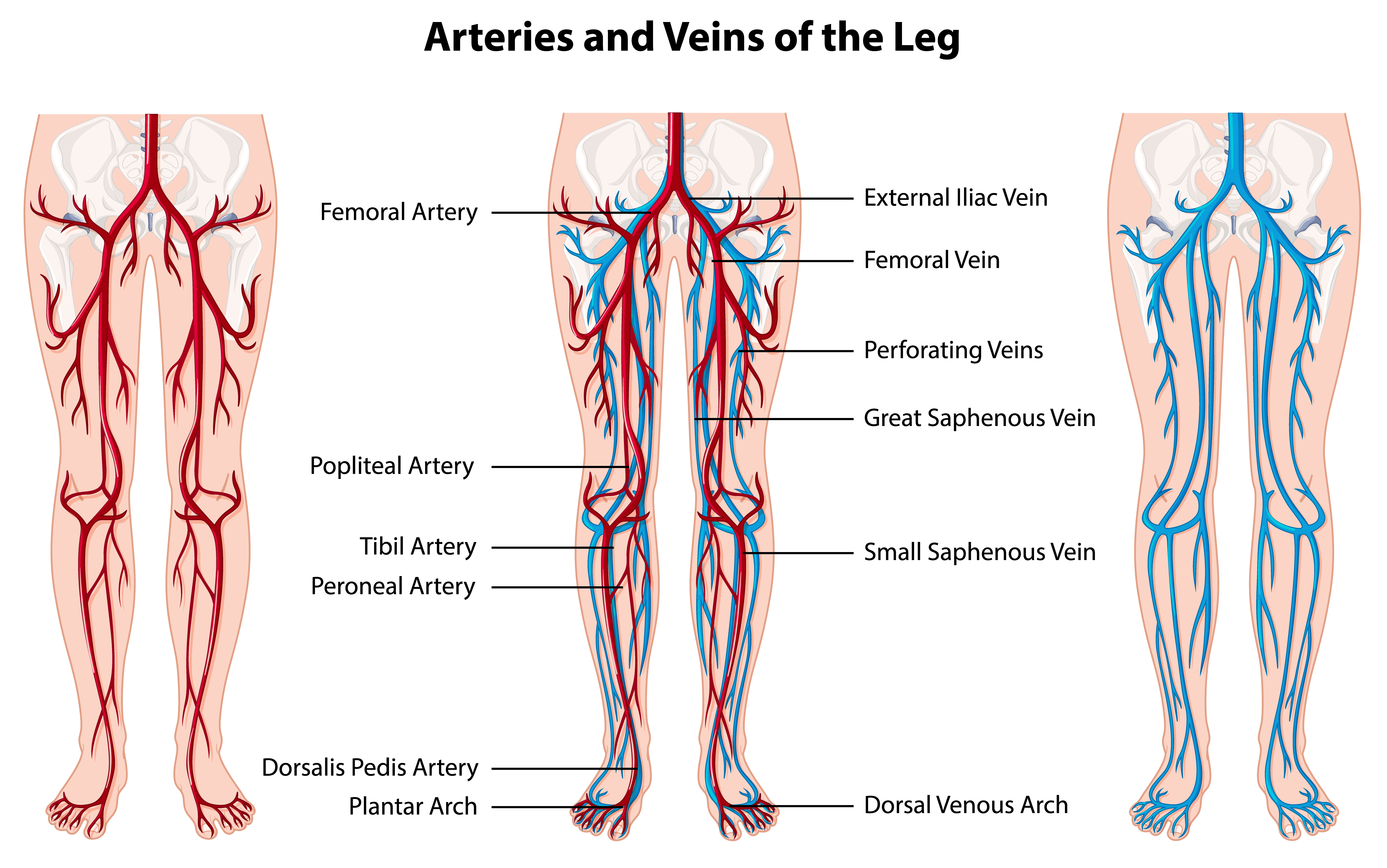  Difference Between Angiography And Angioplasty