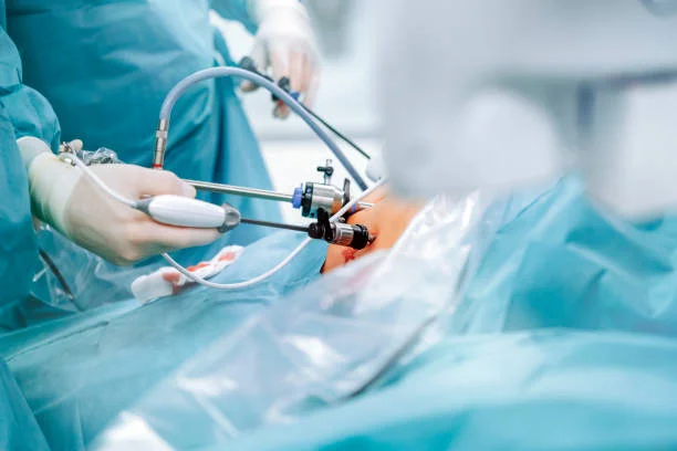 Laparoscopic Surgery