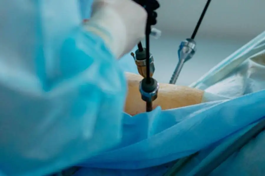 Laparoscopic Hernia Surgery